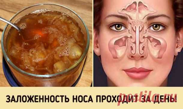 Супер-средство от заложенного носа. Будете свободно дышать уже на утро! — Копилочка полезных советов