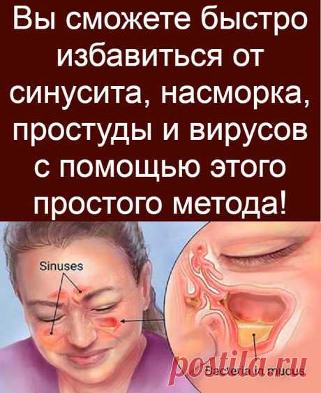 Вы сможете быстро избавиться от синусита, насморка, простуды и вирусов с помощью этого простого метода!