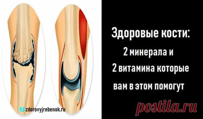 Здоровые кости: 2 минерала и 2 витамина которые вам в этом помогут Здоровые кости: 2 минерала и 2 витамина которые вам в этом помогут.Информация, даже очень важная, имеет обыкновение со временем тускнеть