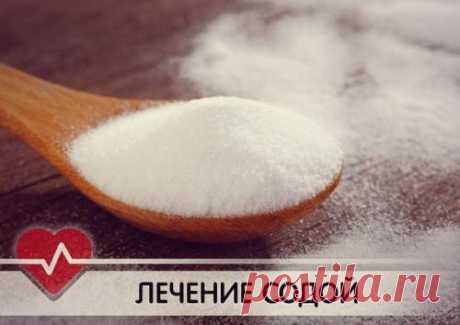 18 РЕЦЕПТОВ ЛЕЧЕНИЯ ПИТЬЕВОЙ СОДОЙ