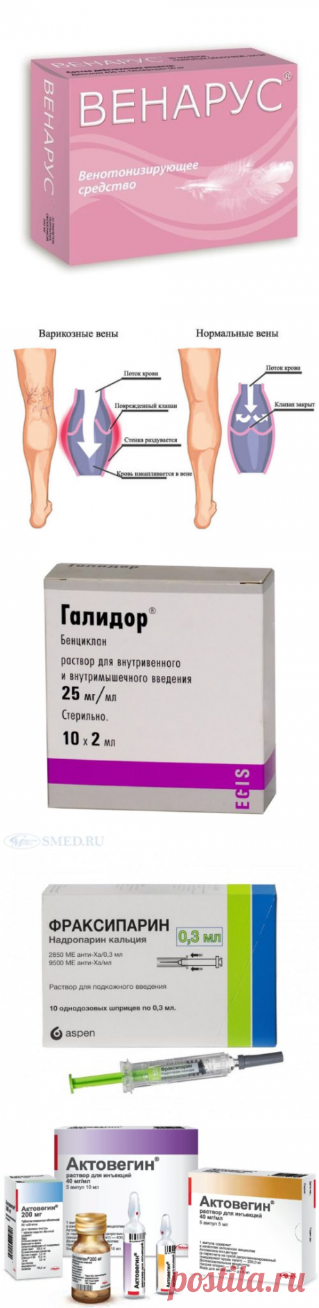Сосудорасширяющие препараты для нижних конечностей: обзор средств
