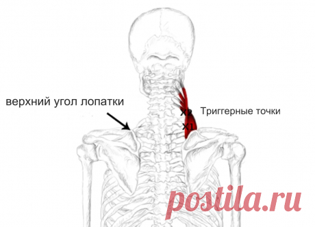 Мышца поднимающая лопатку. Самомассаж