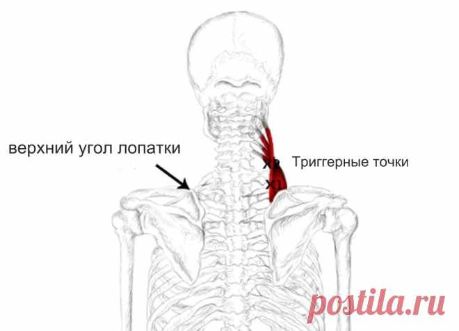 Мышца поднимающая лопатку. Самомассаж