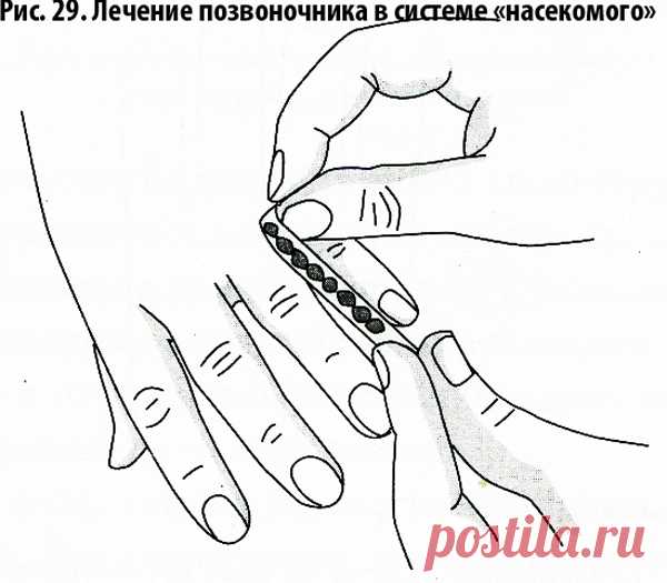 😉: СУ ДЖОК СЕМЯНОТЕРАПИЯ * ПРИНЦИПЫ ПРИМЕНЕНИЯ
СЕМЯН РАСТЕНИЙ