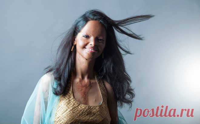 Смелая фотосессия индийских женщин, изуродованных кислотой