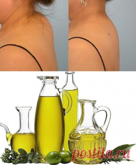 Холка-или отложение солей