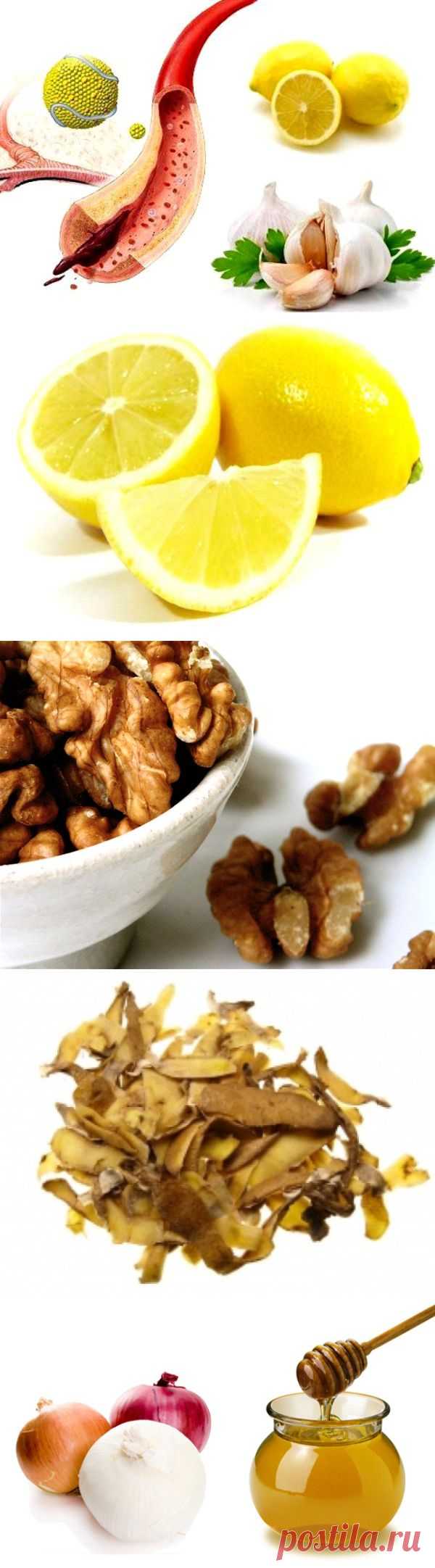 (+1) тема - Как очистить сосуды по народным рецептам | ВСЕГДА В ФОРМЕ!