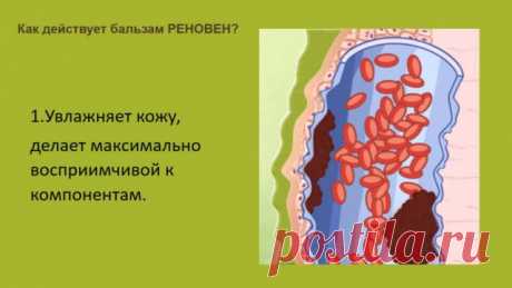 Гель «Реновен» от варикоза: отзывы, инструкция по применению