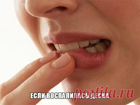 Виктория Луценко Если стоматологическая поликлиника вызывает страх, а у вас воспалилась десна - НАРОДНЫЙ СОВЕТ