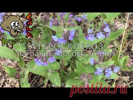 АТЕРОСКЛЕРОЗ: народные способы лечения