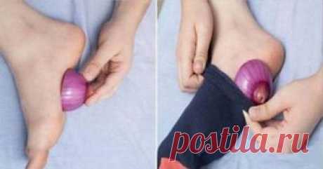 Всего на одну ночь стоит положить лук в носки, и вы будете удивлены тем, что про - стр. 1 - Здоровье, физкультприветы и диеты