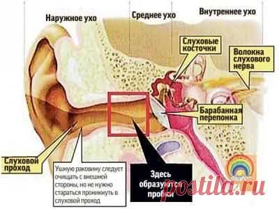 Причины формирования ушной пробки