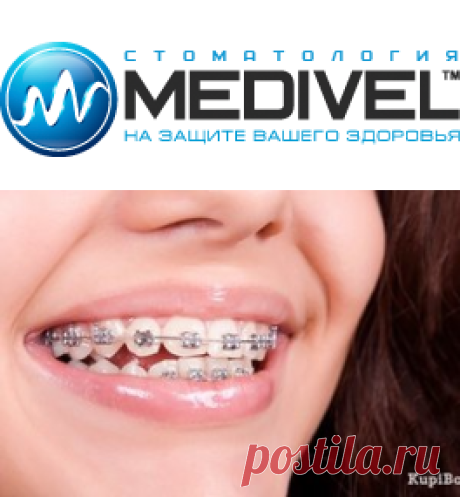 Исправление прикуса брекетами в стоматологии «Medivel» | MEDIVEL