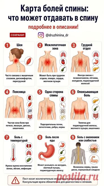 Карта болей спины