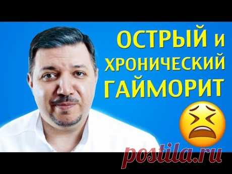 Острый и хронический гайморит | Лечим правильно с Владимиром Зайцевым