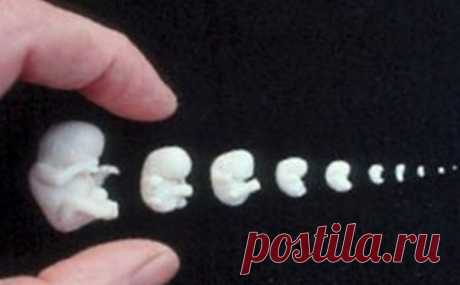 Белые выделения перед месячными: признак заболевания или нет