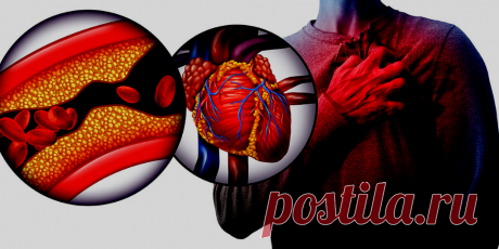 Холестерин, инфаркт … Можно ли очистить сосуды
Сердечно-сосудистые заболевания, инфаркты и инсульты, в нашей стране занимают первое место среди причин преждевременного ухода из жизни. Практически каждый человек находится в группе риска, особенно …
Читай дальше на сайте. Жми подробнее ➡