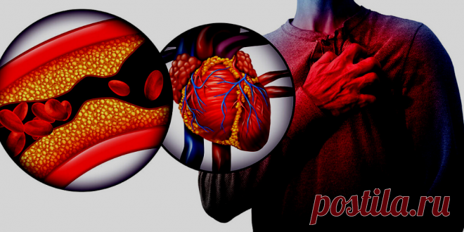 Холестерин, инфаркт … Можно ли очистить сосуды
Сердечно-сосудистые заболевания, инфаркты и инсульты, в нашей стране занимают первое место среди причин преждевременного ухода из жизни. Практически каждый человек находится в группе риска, особенно …
Читай дальше на сайте. Жми подробнее ➡