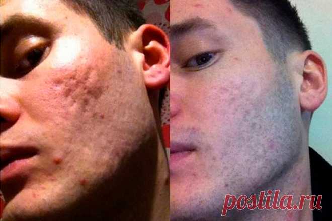 женесс глобал картинки: 12 тыс изображений найдено в Яндекс.Картинках
