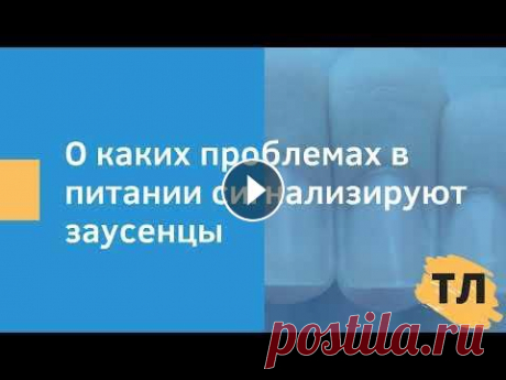 О каких проблемах в питании сигнализируют заусеницы В этом видео я расскажу о таком проблеме, как заусеницы. Вы узнаете какие проблемы со здоровьем приводят к ним, а также как с ними бороться....