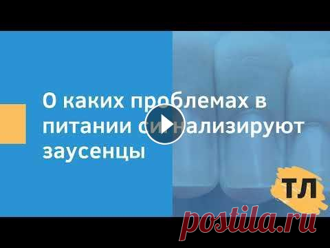О каких проблемах в питании сигнализируют заусеницы В этом видео я расскажу о таком проблеме, как заусеницы. Вы узнаете какие проблемы со здоровьем приводят к ним, а также как с ними бороться....