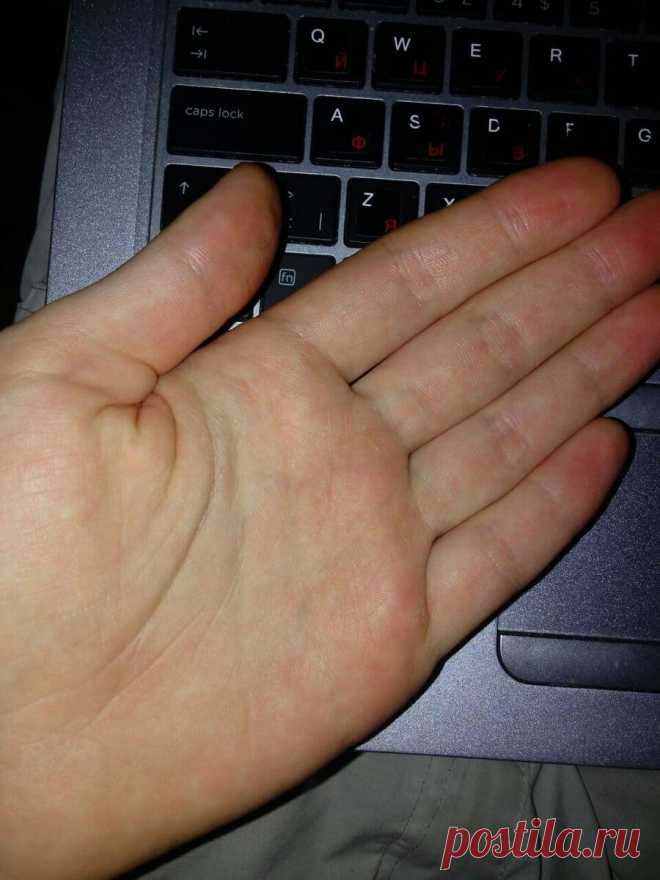 2 скрытых признака плохой работы почек, на который никто не обращает внимание | Природа Лечит | Дзен