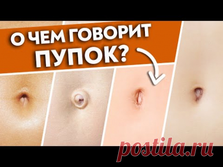 Диагностика органов по пупку | Пупок скажет ВСЁ о вашем здоровье! Постановка пупка на место