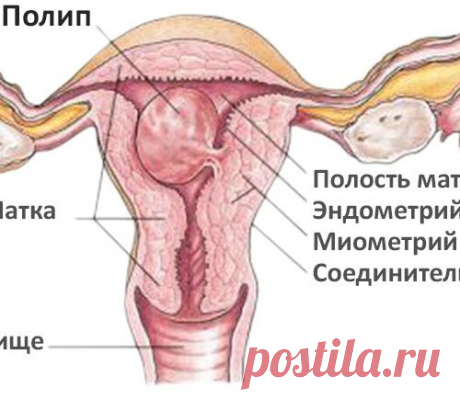 РЕЦЕПТ из интернетаОТ «ЖЕНСКИХ» БОЛЕЗНЕЙ