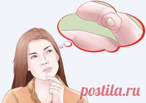 Домашние средства от незначительных ожогов | Я ЗДОРОВ!