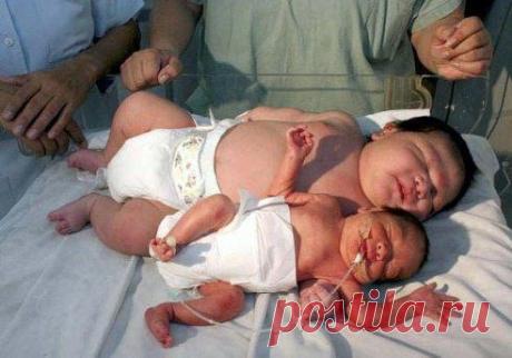 СКОЛЬКО ВЕСИЛ ВАШ ПЕРВЕНЕЦ ПРИ РОЖДЕНИИ?