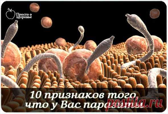 10 признаков того, что у Вас паразиты