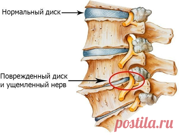 5 СОВЕТОВ, ЧТОБЫ ПОЯСНИЦА НЕ БОЛЕЛА