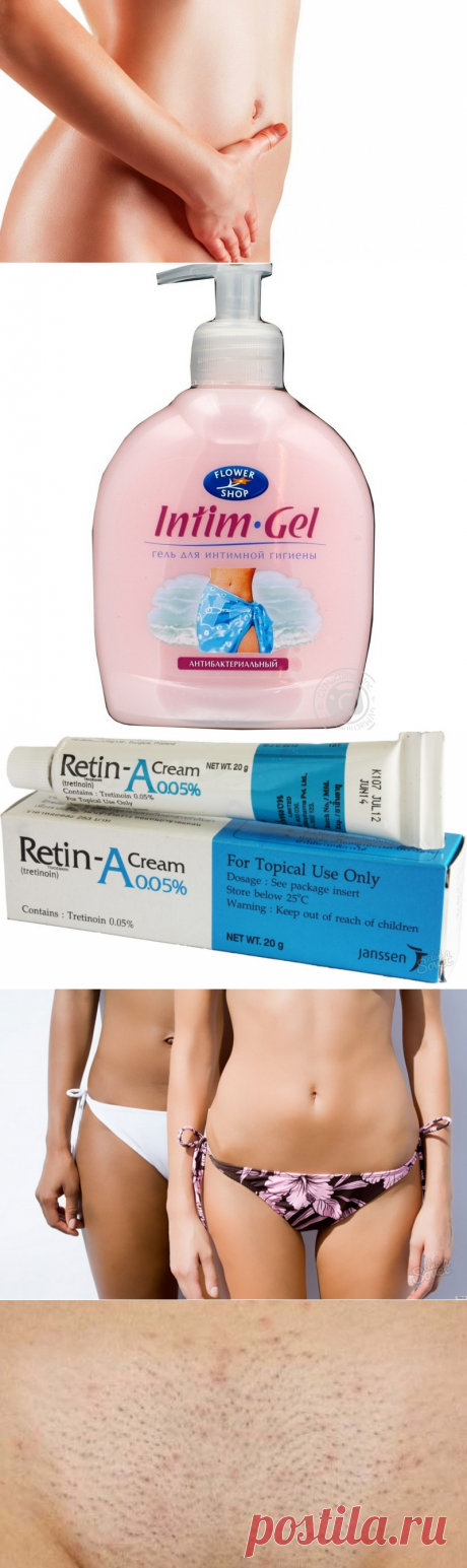 Раздражение на лобке после бритья: советы и рекомендации