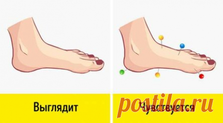 7 неочевидных симптомов, говорящих о том, что у вас нарушено кровообращение
