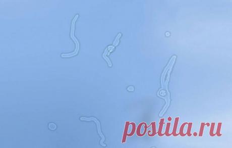 Что это за белые прозрачные штуки, плавающие перед глазами и откуда они берутся