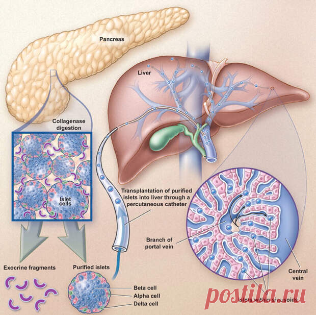 Лечение травами заболеваний печени, желчного пузыря и поджелудочной железы
 Чистотел – растение, обладающее множеством полезных свойств и может выступать в роли антисептика, утолять разного рода боли, очищать организм и помогать в регенерации поврежденных клеток органов.          Одним из свойств чистотела можно назвать очищение организма. Потому-то его и используют при лечении заболеваний...
Читай дальше на сайте. Жми подробнее ➡