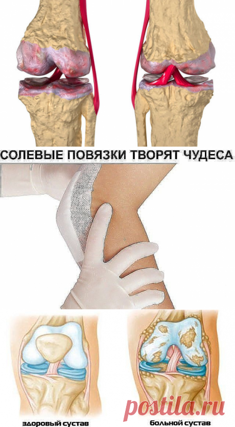 (85) Одноклассники