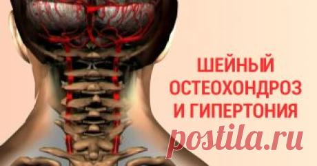 90 % трудоспособного населения страдает от шейного остеохондроза.