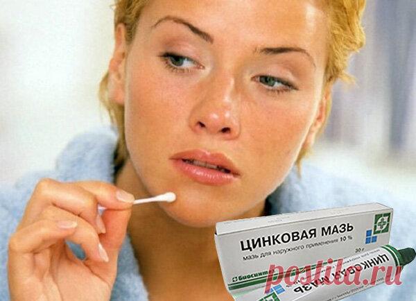 Цинковая мазь от пигментных пятен. Удаляет или защищает?! | Блог о секретах женской красоты | Яндекс Дзен