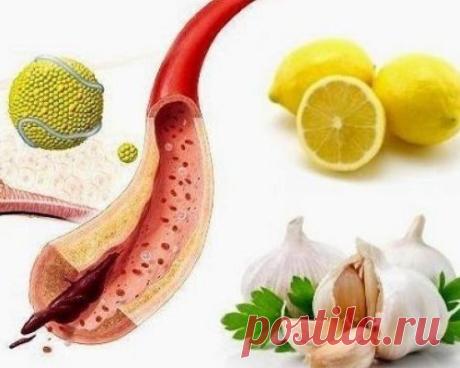 Этот мощный домашний напиток очищает артерии и предупреждает сердечный приступ!
