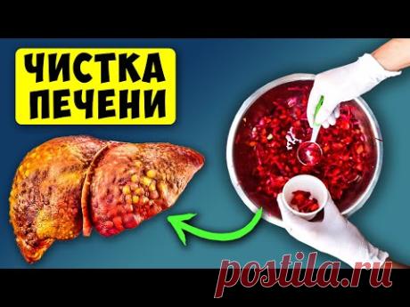 Они быстро Очистят и Восстановят ПЕЧЕНЬ и Желчный от Токсинов, без Лекарств! 10 продуктов