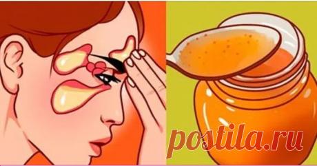 Самые мощнее средства от скопления слизи, избавят от насморка, гайморита, кашля всего за 24 часа! Самые сильные домашние средства, проверенные годами!

Когда у нас простуда или грипп, самое неприятное чувство — это скопление слизи. Дыхание становится затруднительным, и возникает досадный дискомфорт.

Мы предлагаем вам самые сильные домашние средства, которые имеют противоотечное, противомикр