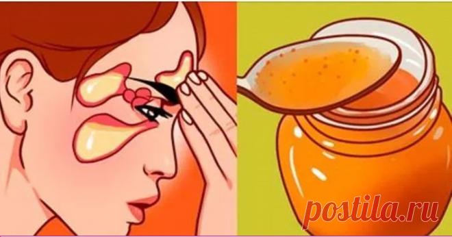 Самые мощнее средства от скопления слизи, избавят от насморка, гайморита, кашля всего за 24 часа! Самые сильные домашние средства, проверенные годами!

Когда у нас простуда или грипп, самое неприятное чувство — это скопление слизи. Дыхание становится затруднительным, и возникает досадный дискомфорт.

Мы предлагаем вам самые сильные домашние средства, которые имеют противоотечное, противомикр