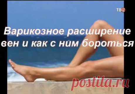 Доктор И... Вылечить варикоз в домашних условиях за месяц? Теперь это возможно!