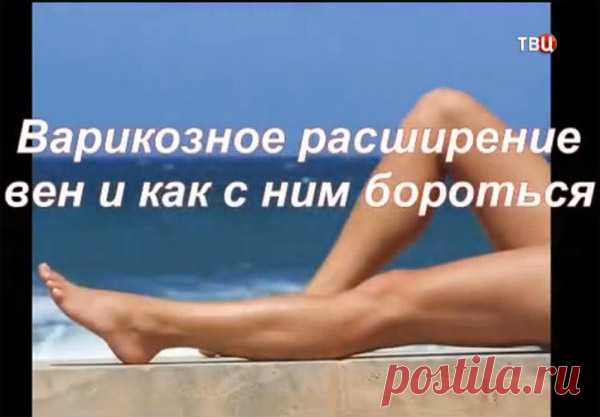 Доктор И... Вылечить варикоз в домашних условиях за месяц? Теперь это возможно!