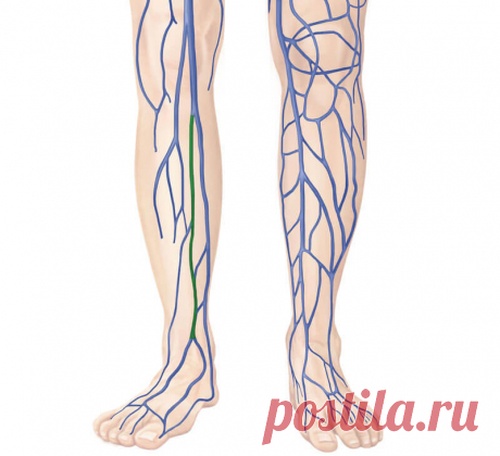 Лимфостаз: Упражнения для очищения лимфы