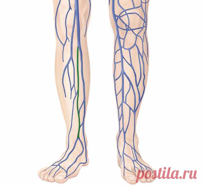 Лимфостаз: Упражнения для очищения лимфы