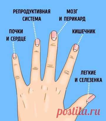 13 проблем со здоровьем, о которых предупреждают лунки на ногтях
Изменения лунки на одном пальце• Лунула (это видимая часть ногтевого корня) на мизинце, как правило, должна быть практически незаметна или вовсе отсутствовать. Связана она с работой почек, тонкого кишечника и сердца. Увеличенная лунка может быть причиной повышенного кровяного давления. • Безымянный палец отвечает за работу репродуктивной и лимфатической систем. Плохо заметная лунка может говорить о проблемах с обменом веществ. • С