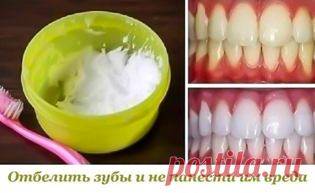 Отбелить зубы и не нанести им вреда. 
 
Данный метод помогает практически при любых заболеваниях десен и при этом почти моментально отбеливает зубы, растворяет камень и залечивает маленькие ранки во рту. 
 
Ингредиенты: 
- 0,5 ч.л. питьевой соды добавить 
- 10-20 капель перекиси водорода (аптечной) 
- несколько капель лимона. 
 
В соду добавить перекись водорода и сок лимона. Паста готова! 
 
Ватку обмакиваем в пасту и натираем пастой зубы и десны снаружи и изнутри. 
 
Лим...