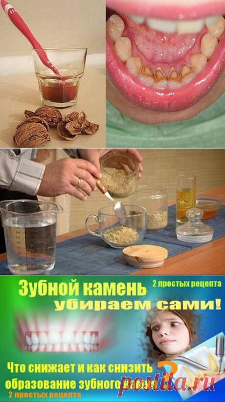 (1) Одноклассники
